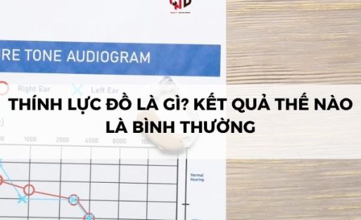 Thính lực đồ là gì